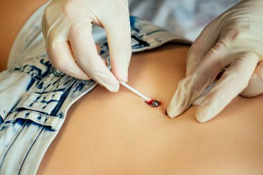 Ustanın yakın plan lastik eldiveni, karnında bandaj ve karnında pamuk olan genç bir kadının göbeğini delip geçer. göbek halka piercing işlemini başlat