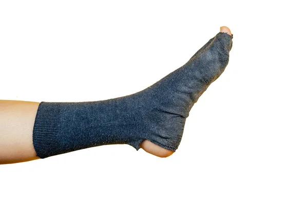 Alte stinkende Socke voller Löcher am Bein auf weißem Hintergrund — Stockfoto