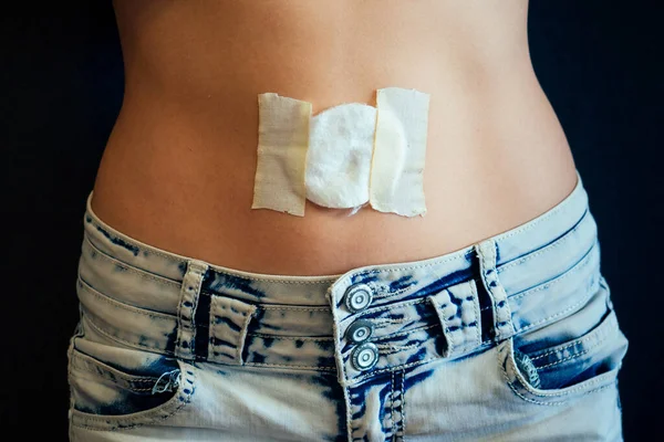 Belly of a young woman with a bandage and cotton on her stomach. care navel ring piercing concept — Stock Photo, Image