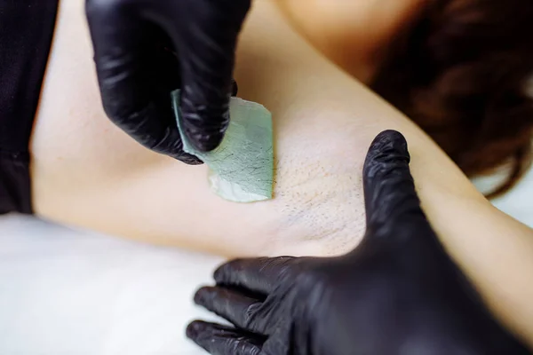 Medical hot wax epilation in spa salon — Stock Photo, Image
