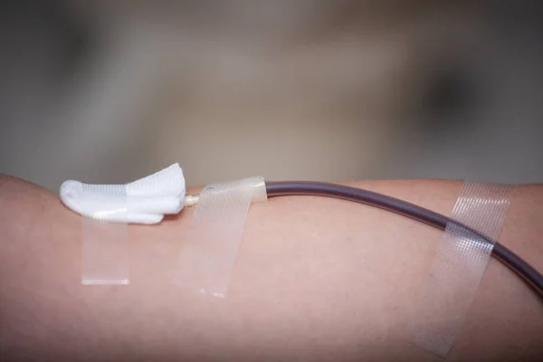 Arm van bloed donateur met naald. — Stockfoto