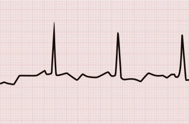 Kalp çizgi grafiği. vektör çizim