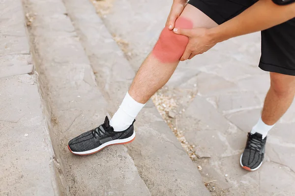 Dolor Pierna Mientras Corre Dolor Rodilla Las Articulaciones Correr — Foto de Stock