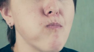 kız ağzına dolu lezzetli bir Apple çiğneme iştah açıcı