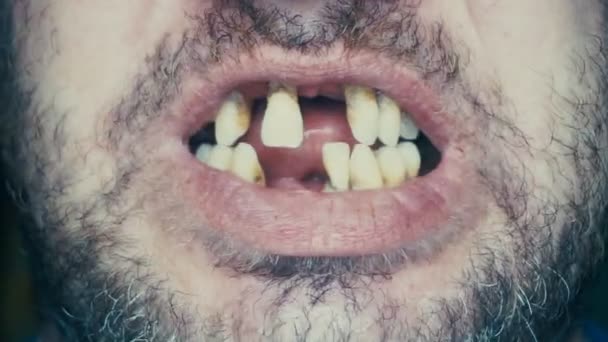 无牙的人微笑着 一个中年 愚蠢的人没有牙齿 老人的牙齿掉了软对焦 — 图库视频影像