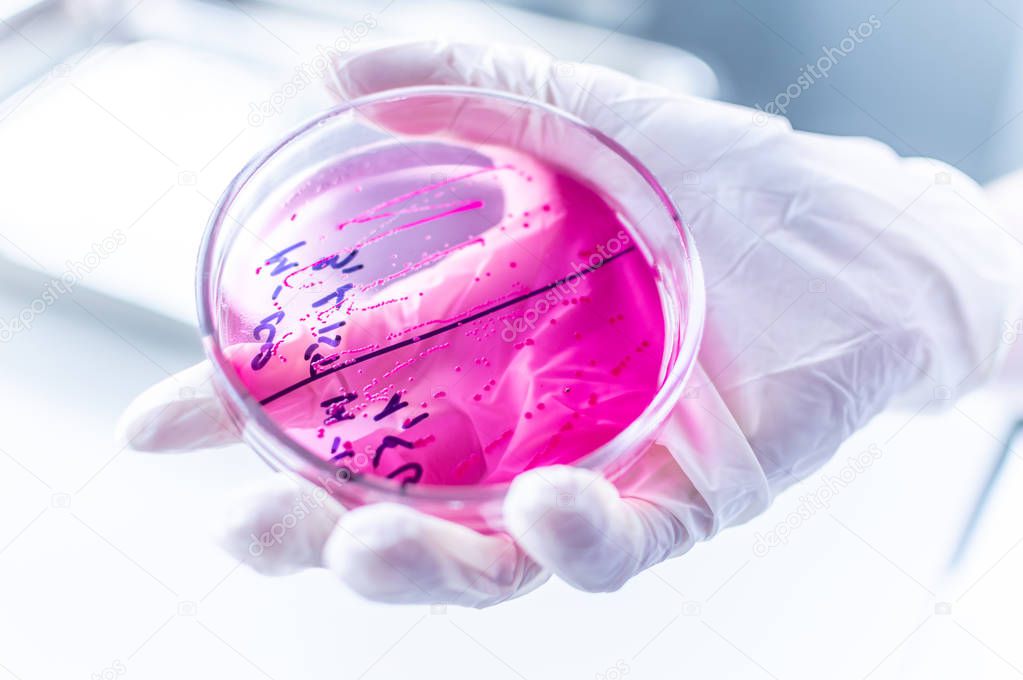 petri dish in the laboratory