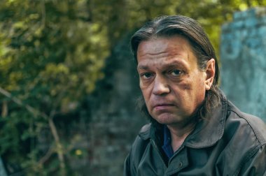 Harabelerde oturan yanağında çürük olan evsiz bir adam. Yoksul -luk. Aç -lık.