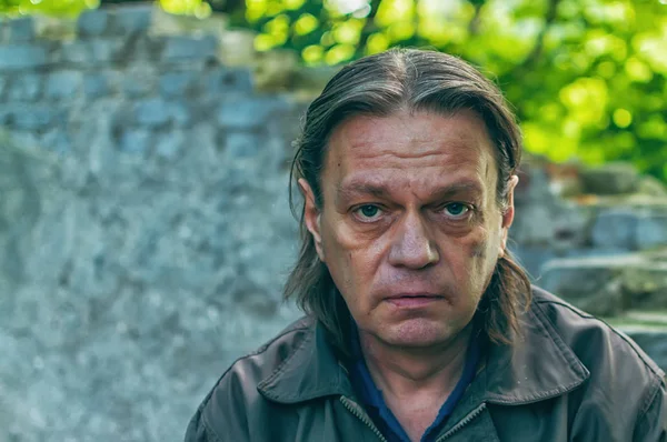 Harabelerde oturan yanağında çürük olan evsiz bir adam. Yoksul -luk. Aç -lık.