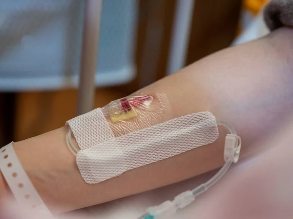 Hasta koluna yerleştirilmiş bir kanülü kapat.