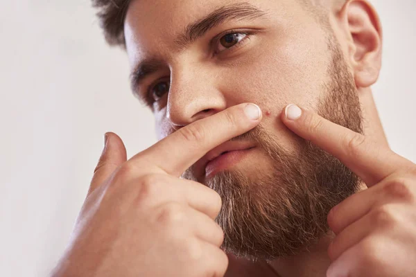 Close Photo Young Man Looking Acnes His Face Grey Background — Stock Photo, Image