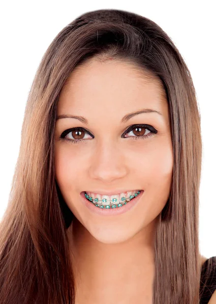 Hermoso Retrato Una Joven Con Corchetes Ojos Marrones — Foto de Stock