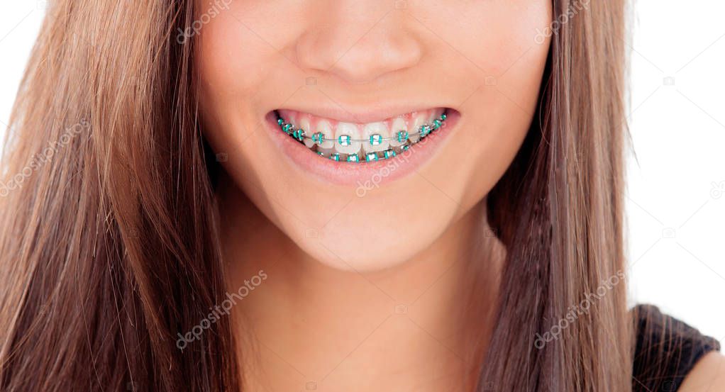 Attractive young woman with brackets isolated on a white backgroung