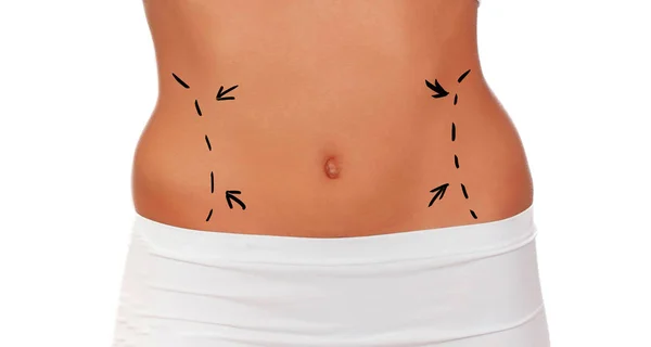 Woman body plastic surgery operation — Stock Photo, Image