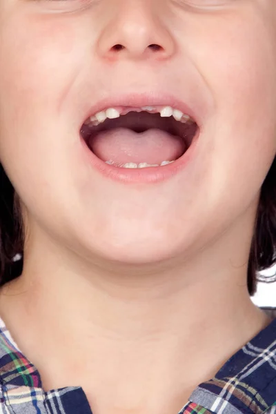 Ağzını Açan Dişsiz Bir Çocuk — Stok fotoğraf