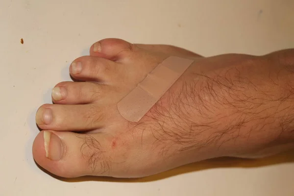 Injured foot with bleeding abrasion wound isolated on white background. — Stock Photo, Image