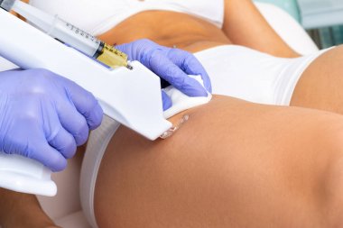 Terapist kadın uyluk mikro iğne teknolojisi ile mezoterapi selülit tedavisi yapıyor.