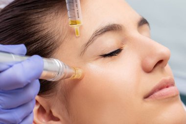 Terapist inklütme enzimleri makro yakın ve kadının gözleri etrafında derma kalem ile.