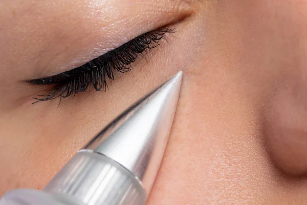 Macro Close Woman Having Noninvasive Cosmetic Facial Plasma Pen Cone — Stock Photo, Image