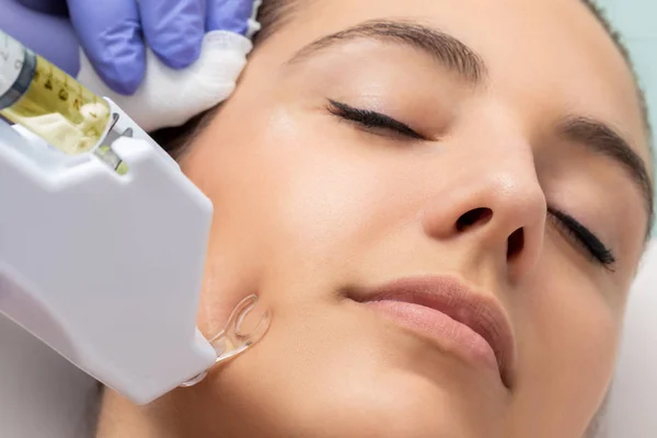傷跡を取り除くために女性の頬にマイクロニードル非侵襲手術を行うセラピスト — ストック写真