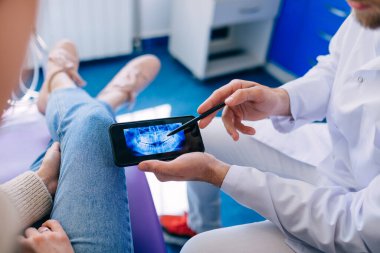 Diş röntgenini kadın hastaya gösteren bir telefonla dişçiyi kapatın. dişçi ofisi.