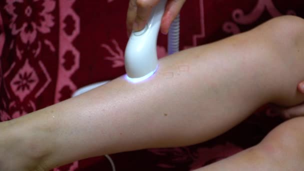 Mädchen Laser Epilator Entfernt Haare Auf Dem Schienbein — Stockvideo