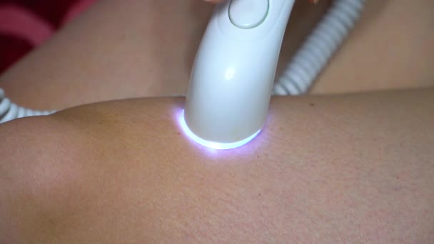 Mädchen Mit Einem Laser Epilator Führt Den Eingriff Der Haarentfernung — Stockvideo