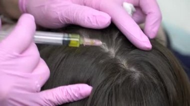 Kozmetolog saç arasındaki ayrılık hasta için kızın başında çeşitli enjeksiyonları yapar. Saç enjeksiyonu.
