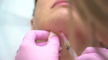 Kozmetolog hasta için kızın çene alanında çeşitli enjeksiyonları gerçekleştirir. Botox enjeksiyon.