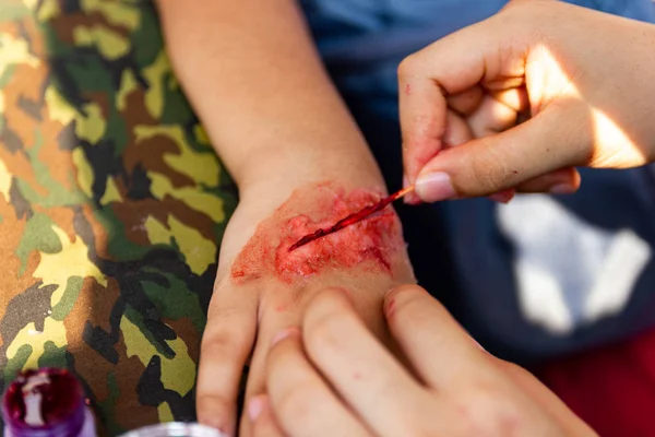 Experte Gefälschte Wunden Vortäuschen Wunden Den Armen Von Kindern Kleiden — Stockfoto