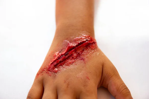 Ψεύτικο Πληγές Στους Βραχίονες Των Παιδιών Φόρεμα Πληγή Ειδικό Εφέ — Φωτογραφία Αρχείου