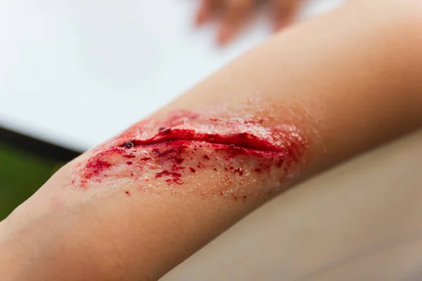 Heridas Falsas Los Brazos Los Niños Visten Herida Efecto Especial — Foto de Stock