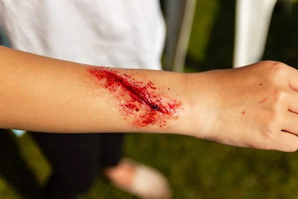 Heridas Falsas Los Brazos Los Niños Visten Herida Efecto Especial —  Fotos de Stock