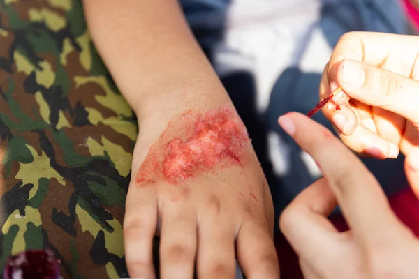 Mensen Met Een Handicap Zittend Een Rolstoel Gaan Buiten — Stockfoto