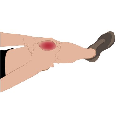 Tendon diz eklemi sorunları ağrılı, egzersiz vektör illüstrasyon sonra şişme