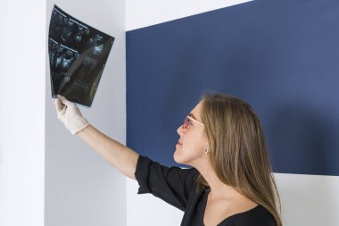 Kadın Doktor Röntgen seyir