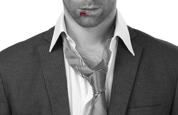Close Homem Negócios Com Lábio Sangrento Espancado Machucado Isolado — Fotografia de Stock