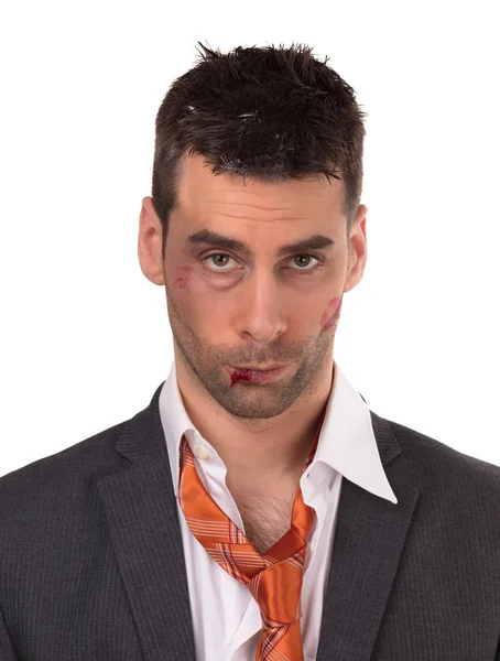 Close up of a businessman with bloody lip, beaten and bruised — Stock Photo, Image