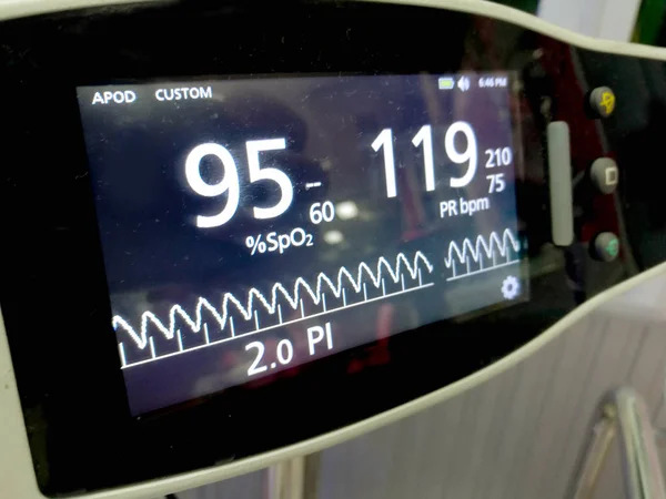 Vértes Képernyő Kijelzőn Beteg Kórházban Oxigén Telítettség Mérőkészülékek — Stock Fotó