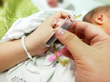 Hasta yeni doğan bebek yandan IV kateter bıçak kullanarak ve onun kana-kan tüpü için check-up glikoz ve tüm virüs NICU wards, kanında süzülmüş çocuk hemşiresi, eller.