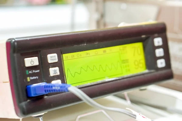 对某医院病人氧血饱和度仪和脉冲脉搏显示进行测量 脉冲脉搏显示是用于监测缺氧问题患者症状的装置 — 图库照片
