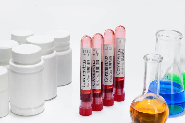 Covid Teste Amostra Laboratório Exames Sangue Para Diagnóstico Infecção Por — Fotografia de Stock