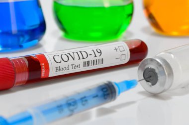 COVID-19 laboratuvar test tüpü ve teşhis koronavirüs enfeksiyonu ilaçları ve farmakoloji için laboratuvar örneği.