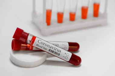 COVID-19 laboratuvar test tüpü ve teşhis koronavirüs enfeksiyonu için kan testi örneği. 