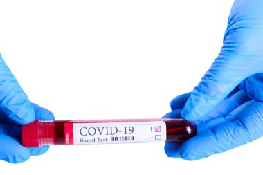 KOVID-19 test ve teşhis koronavirüs enfeksiyonu için yapılan kan testinin laboratuvar numunesi beyaz arka planda ve reklam konsepti için izole edilmiş laboratuvar asistanının ellerinde.