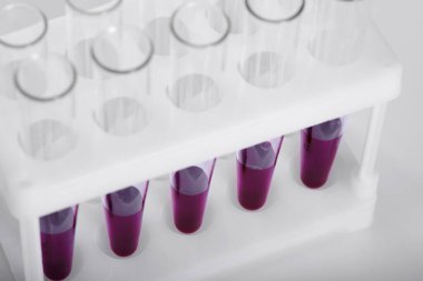 Tıp laboratuarında kan tüpleri. Bilim ve araştırma. Kimse.