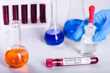 KOVID-19 test ve laboratuvar asistanı şişelerinde teşhis koronavirüs enfeksiyonu için yapılan kan testleri ve laboratuvar örnekleri.