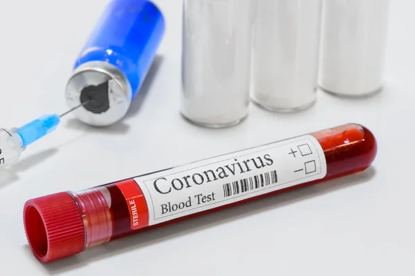 Covid Laboratory Test Tube Laboratory Sample Blood Testing Diagnosis Coronavirus — Stock Photo, Image