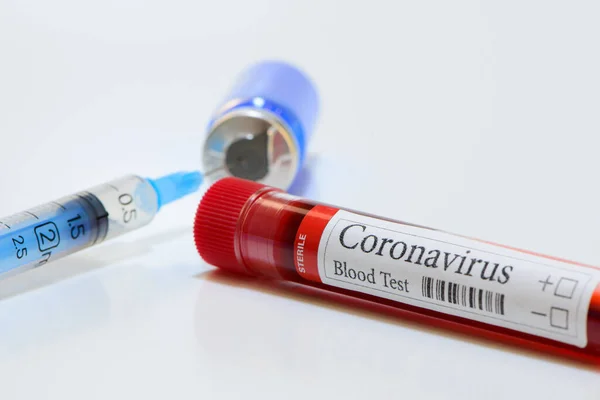 Covid Laboratory Test Tube Laboratory Sample Blood Testing Diagnosis Coronavirus — Stock Photo, Image