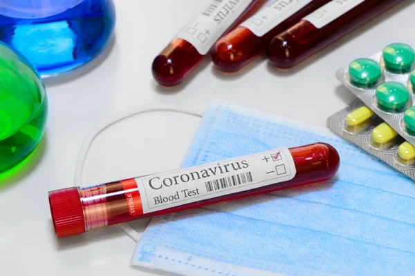 Covid Laboratory Test Tube Laboratory Sample Blood Testing Diagnosis Coronavirus — Stock Photo, Image