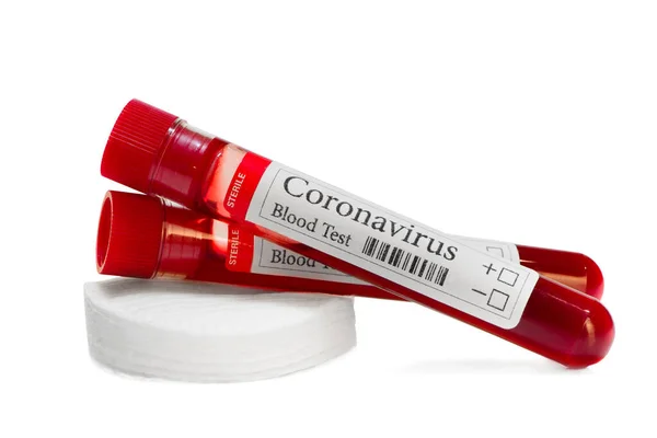 Covid Laboratory Test Tube Laboratory Sample Blood Testing Diagnosis Coronavirus — Stock Photo, Image